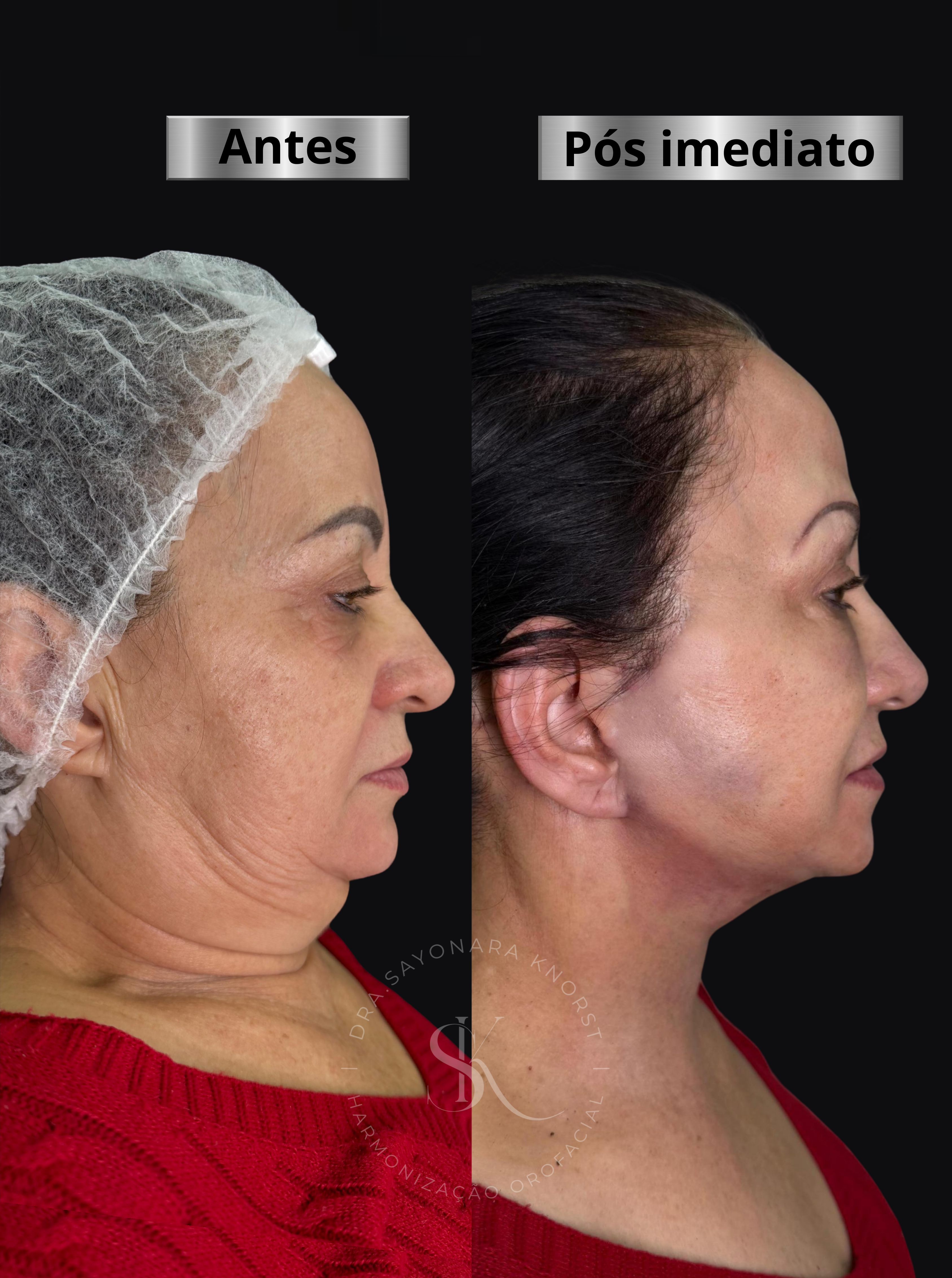 FaceSculptSK03